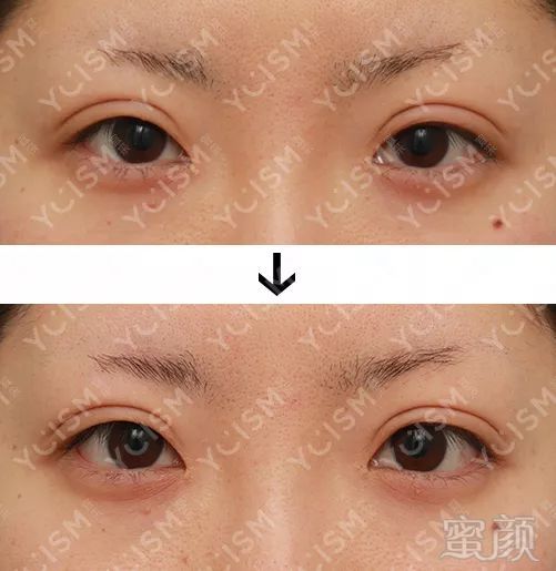 https://img.miyanlife.com/mnt/timg/190627/12114955E-2.jpg