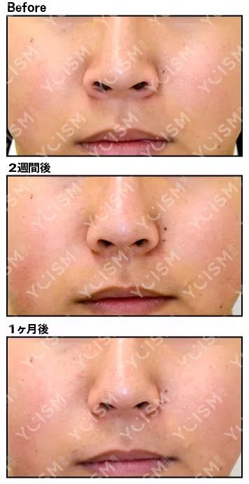 https://img.miyanlife.com/mnt/timg/190627/1211502963-8.jpg