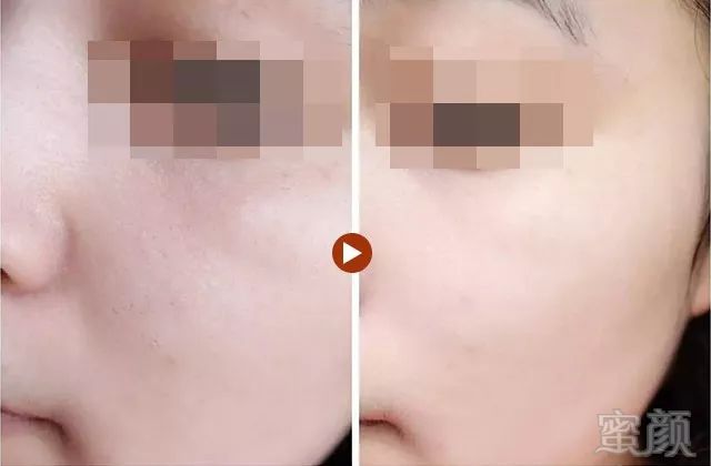 https://img.miyanlife.com/mnt/timg/190627/1212261S0-0.jpg