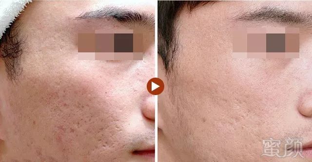 https://img.miyanlife.com/mnt/timg/190627/12122J932-2.jpg