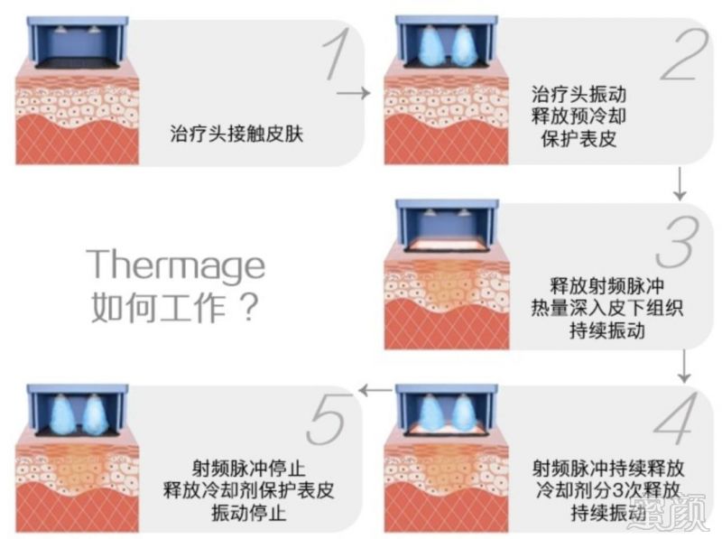 https://img.miyanlife.com/mnt/timg/190627/121S93K2-5.jpg