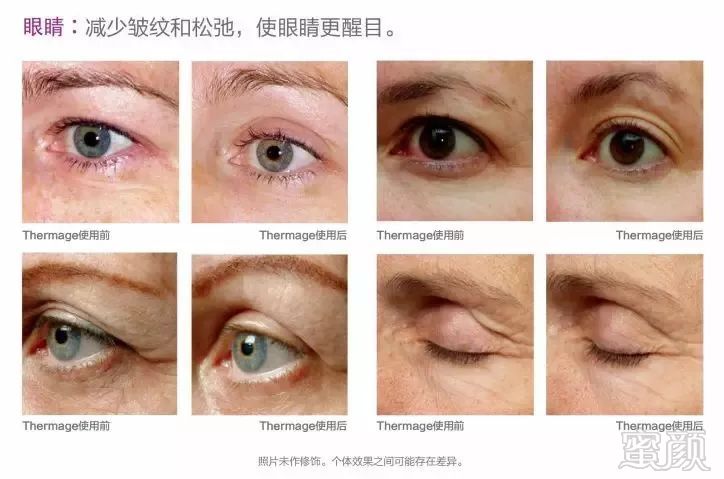 https://img.miyanlife.com/mnt/timg/190627/121T0FB-11.jpg