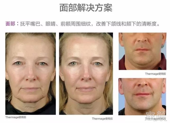 https://img.miyanlife.com/mnt/timg/190627/121T0I64-10.jpg