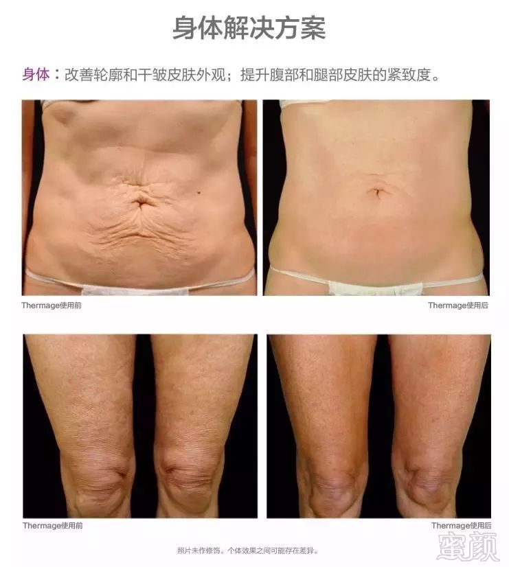 https://img.miyanlife.com/mnt/timg/190627/121T16437-12.jpg