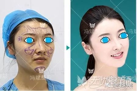 https://img.miyanlife.com/mnt/timg/190627/1226022V0-2.jpg