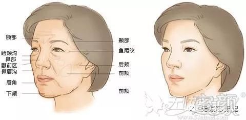 https://img.miyanlife.com/mnt/timg/190627/12260241X-0.jpg