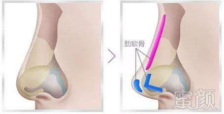 案例图片