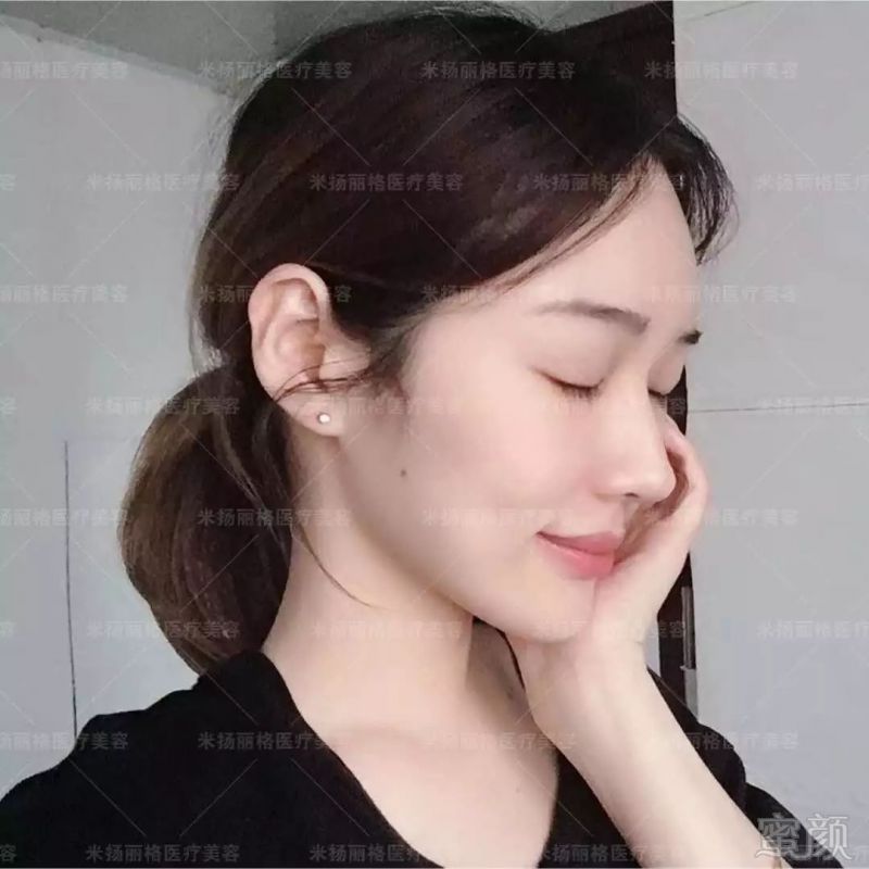 https://img.miyanlife.com/mnt/timg/190628/1119296050-7.jpg
