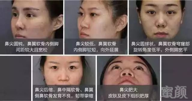 https://img.miyanlife.com/mnt/timg/190628/11192G619-1.jpg