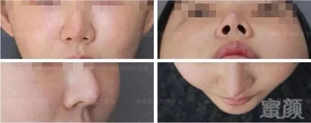 https://img.miyanlife.com/mnt/timg/190628/11192T032-4.jpg