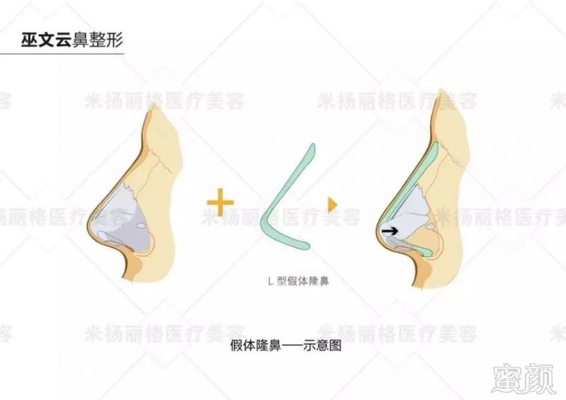 https://img.miyanlife.com/mnt/timg/190628/11192W600-3.jpg