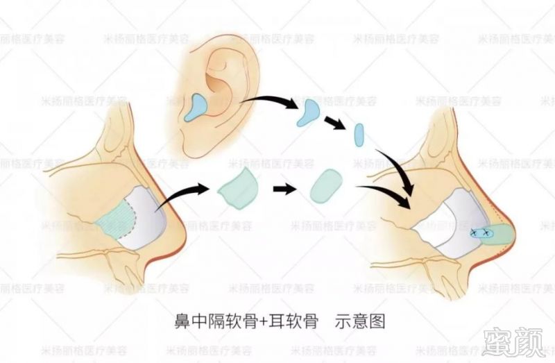 https://img.miyanlife.com/mnt/timg/190628/11192a114-6.jpg