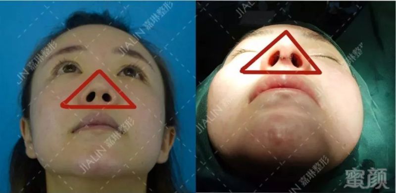 https://img.miyanlife.com/mnt/timg/190628/11350564A-6.jpg