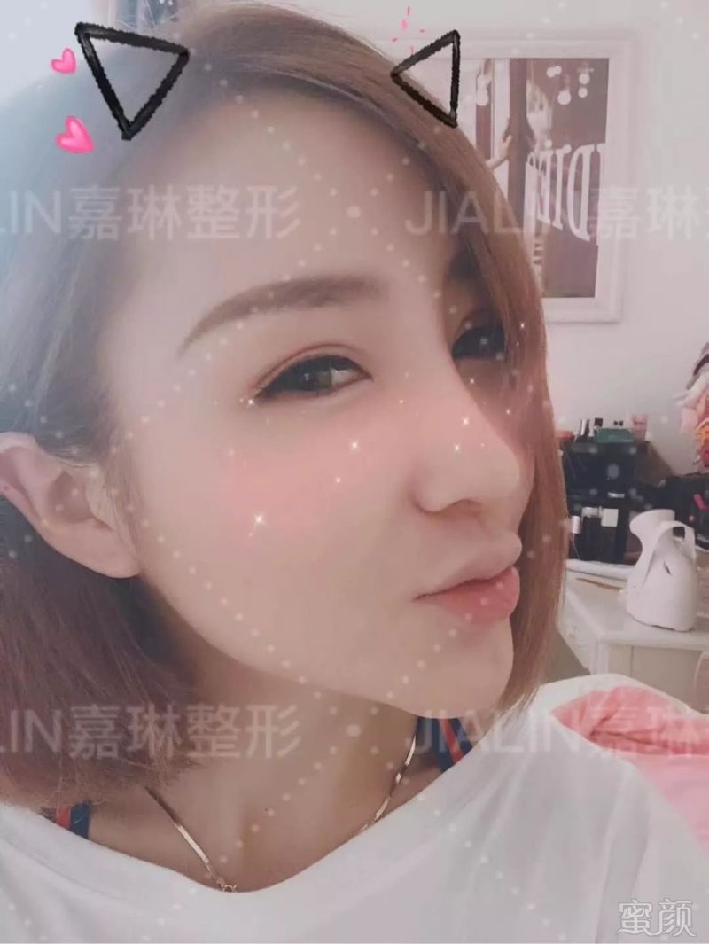 https://img.miyanlife.com/mnt/timg/190628/11350B434-9.jpg