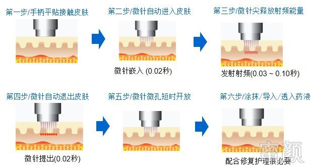 案例图片