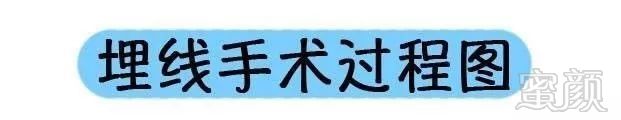 https://img.miyanlife.com/mnt/timg/190628/1231543959-2.jpg