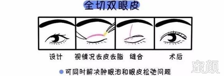 https://img.miyanlife.com/mnt/timg/190628/1231555X3-4.jpg