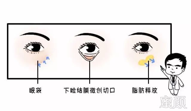 https://img.miyanlife.com/mnt/timg/190628/1231561044-10.jpg