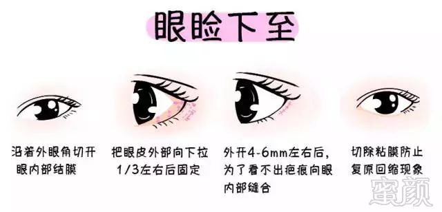 https://img.miyanlife.com/mnt/timg/190628/12315A059-9.jpg