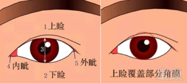 https://img.miyanlife.com/mnt/timg/190628/12324S1I-2.jpg