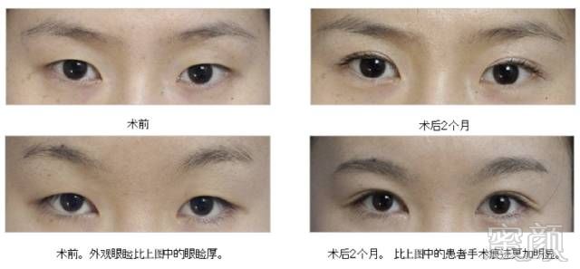 https://img.miyanlife.com/mnt/timg/190628/12324a142-7.jpg