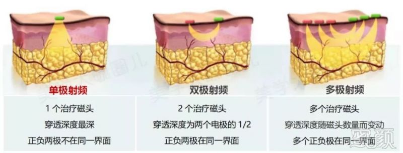https://img.miyanlife.com/mnt/timg/190629/115505E02-1.jpg