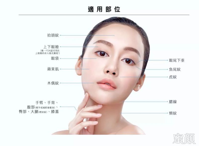 https://img.miyanlife.com/mnt/timg/190629/11553L2B-15.jpg