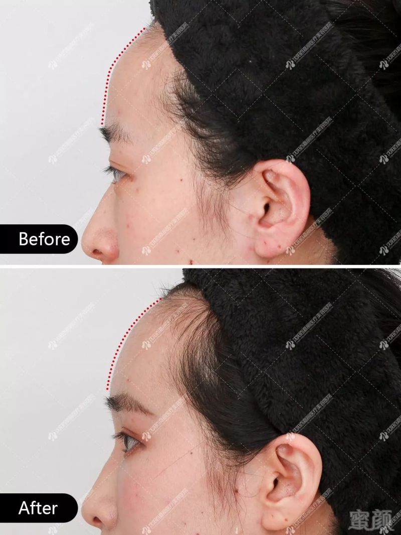 https://img.miyanlife.com/mnt/timg/190629/115A53X4-4.jpg