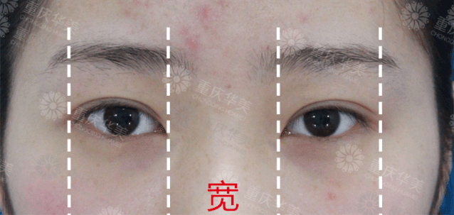 https://img.miyanlife.com/mnt/timg/190629/12005I523-12.jpg