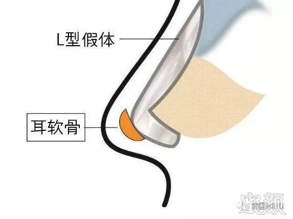 https://img.miyanlife.com/mnt/timg/190629/1212402136-2.jpg
