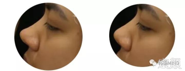 https://img.miyanlife.com/mnt/timg/190629/1212412401-7.jpg
