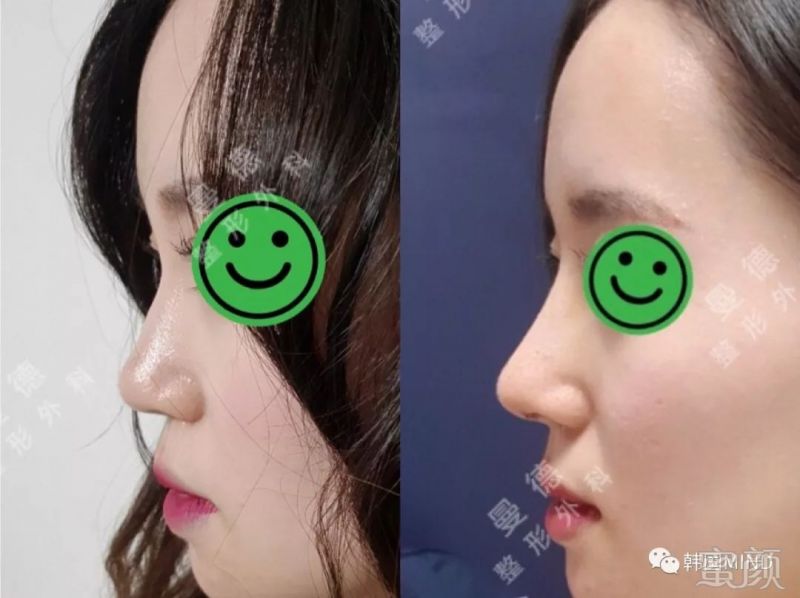 https://img.miyanlife.com/mnt/timg/190629/1212424156-12.jpg