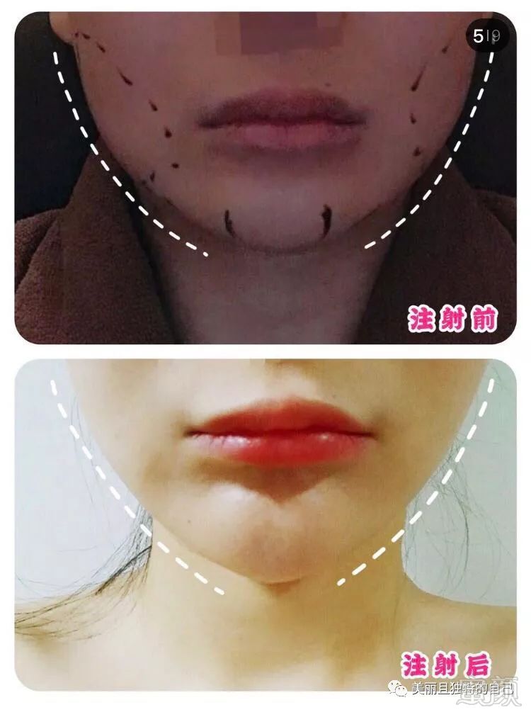 https://img.miyanlife.com/mnt/timg/190629/1243495K9-6.jpg