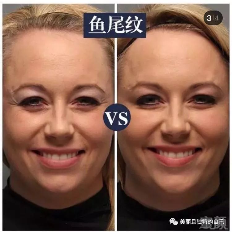https://img.miyanlife.com/mnt/timg/190629/12434S354-2.jpg