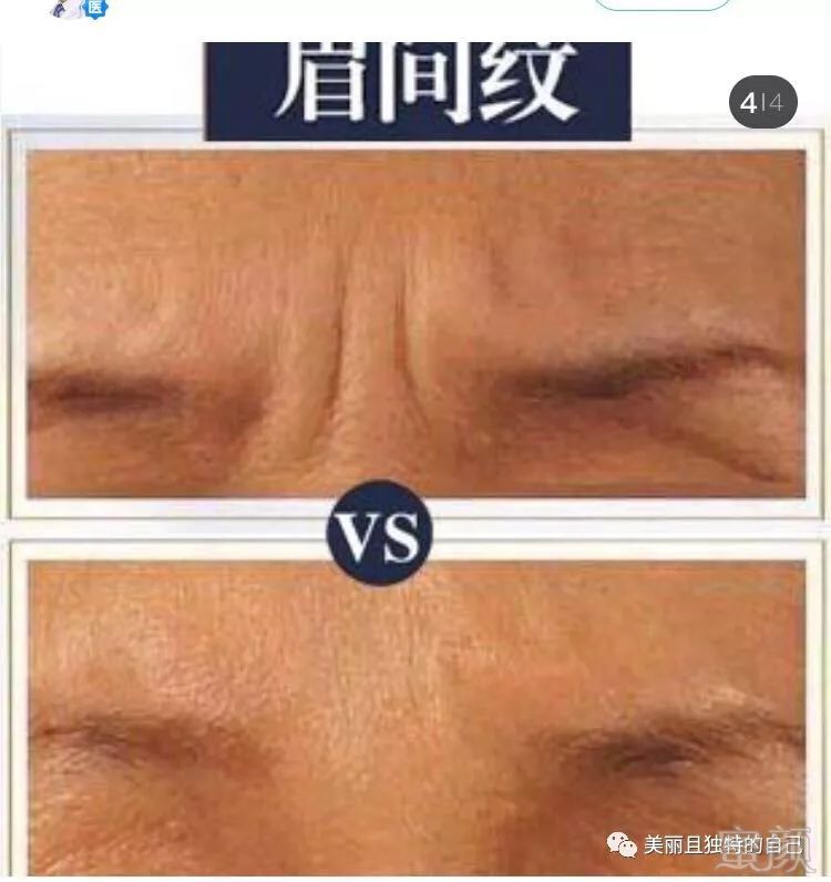 https://img.miyanlife.com/mnt/timg/190629/12434U0W-3.jpg