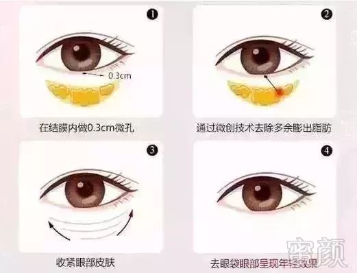 https://img.miyanlife.com/mnt/timg/190630/1102493540-4.jpg