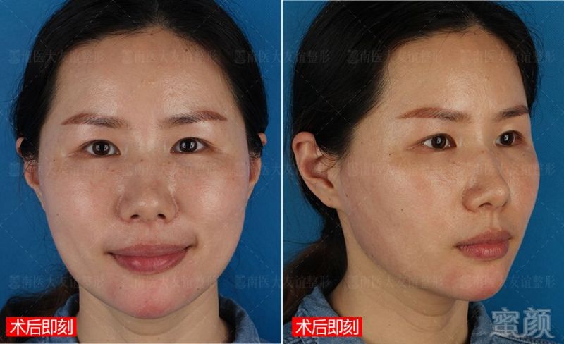 https://img.miyanlife.com/mnt/timg/190630/1103401N0-5.jpg