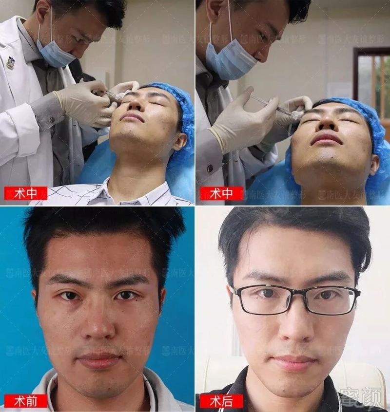https://img.miyanlife.com/mnt/timg/190630/1103425108-10.jpg