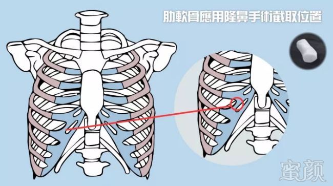 https://img.miyanlife.com/mnt/timg/190630/110J64103-3.jpg