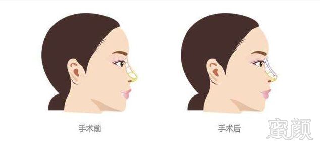 https://img.miyanlife.com/mnt/timg/190630/110JA028-4.jpg