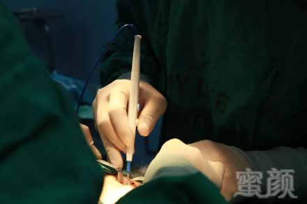 https://img.miyanlife.com/mnt/timg/190630/110JC208-2.jpg