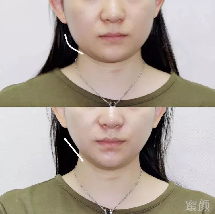 https://img.miyanlife.com/mnt/timg/190630/111A351M-3.jpg