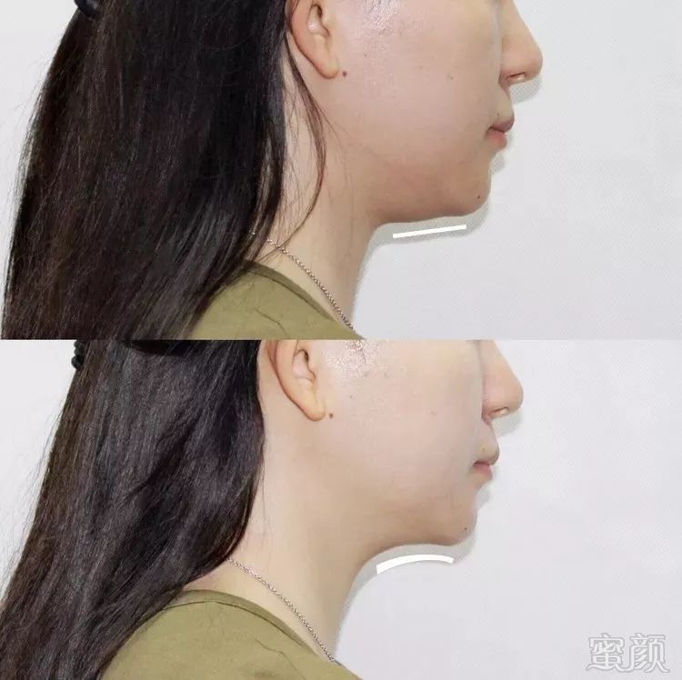 https://img.miyanlife.com/mnt/timg/190630/111A43A6-5.jpg