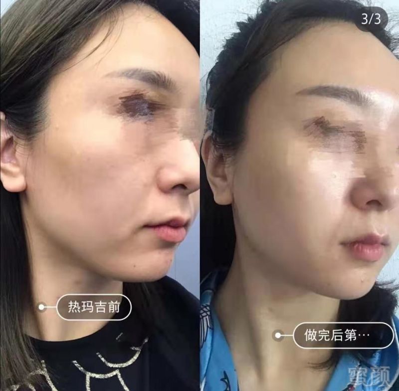 https://img.miyanlife.com/mnt/timg/190630/111R110J-10.jpg