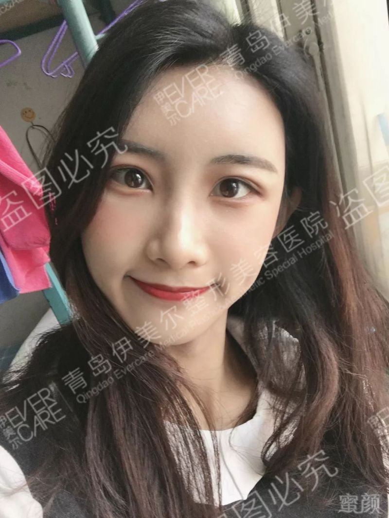 https://img.miyanlife.com/mnt/timg/190630/1141003103-5.jpg