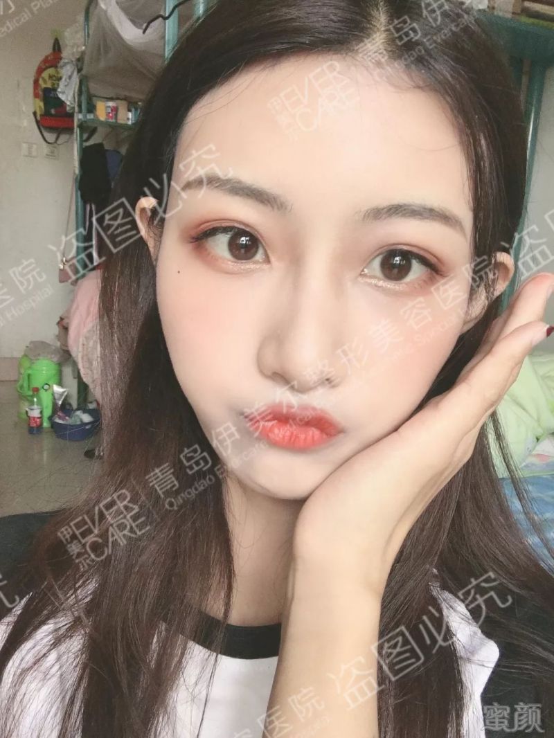https://img.miyanlife.com/mnt/timg/190630/1141061Q8-11.jpg