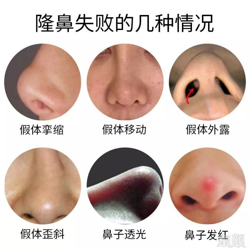 https://img.miyanlife.com/mnt/timg/190630/114412Kb-2.jpg