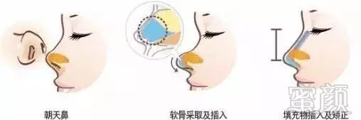 https://img.miyanlife.com/mnt/timg/190701/11231240U-8.jpg