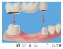 案例图片