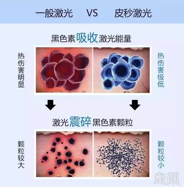 https://img.miyanlife.com/mnt/timg/190701/1149342943-2.jpg